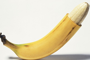 children and adults circumcision With Doctor Dr Lebea Medical Practice in Alexandra, Wynberg, Johannesburg, SA